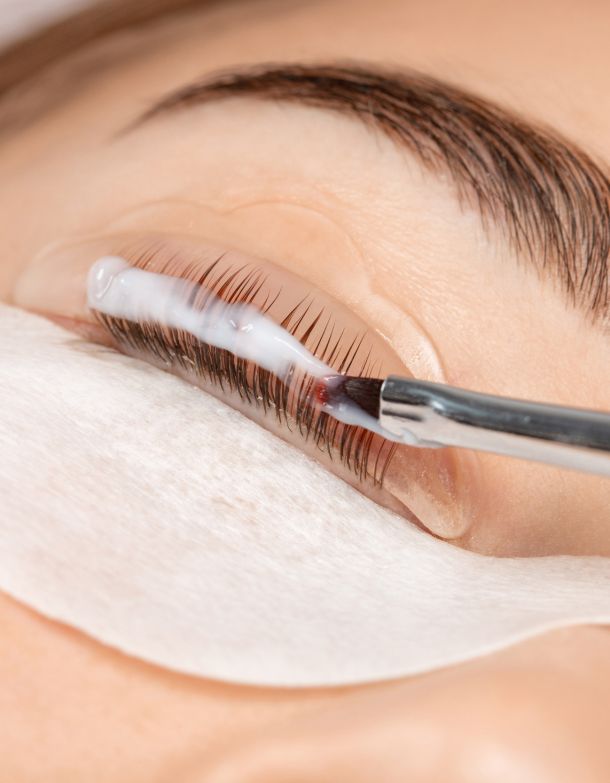 Lasheslifting Gotha